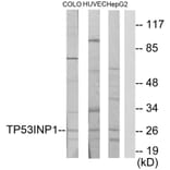 Western Blot - Anti-TP53INP1 Antibody (C11471) - Antibodies.com