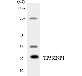 Western Blot - Anti-TP53INP1 Antibody (R12-3644) - Antibodies.com