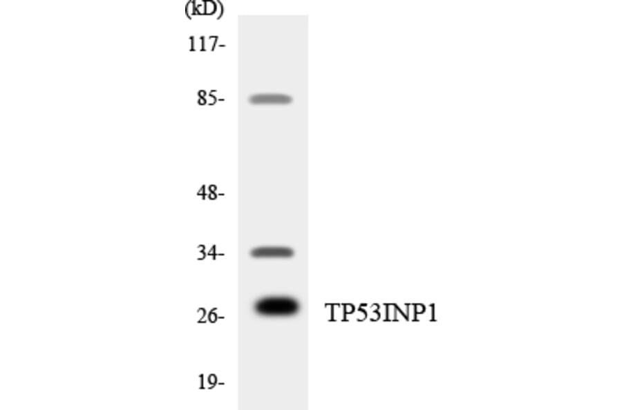 Western Blot - Anti-TP53INP1 Antibody (R12-3644) - Antibodies.com