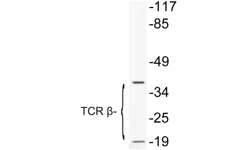 Western Blot - Anti-TCR beta Antibody (R12-2377) - Antibodies.com