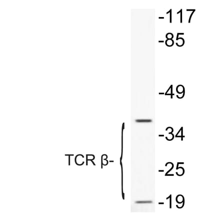Western Blot - Anti-TCR beta Antibody (R12-2377) - Antibodies.com