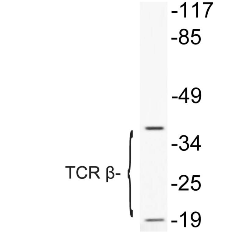 Western Blot - Anti-TCR beta Antibody (R12-2377) - Antibodies.com