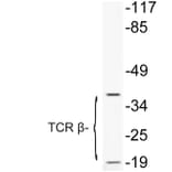 Western Blot - Anti-TCR beta Antibody (R12-2377) - Antibodies.com