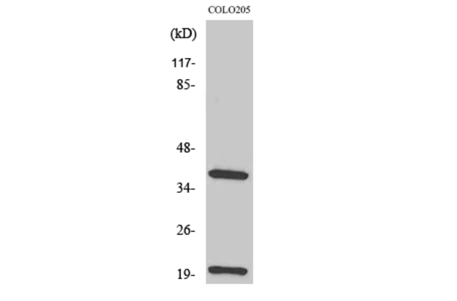 Western Blot - Anti-TCR beta Antibody (R12-2377) - Antibodies.com