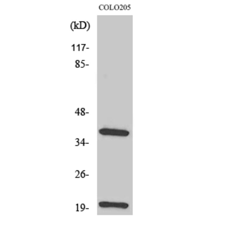 Western Blot - Anti-TCR beta Antibody (R12-2377) - Antibodies.com