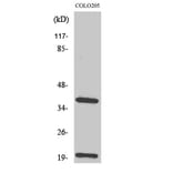 Western Blot - Anti-TCR beta Antibody (R12-2377) - Antibodies.com