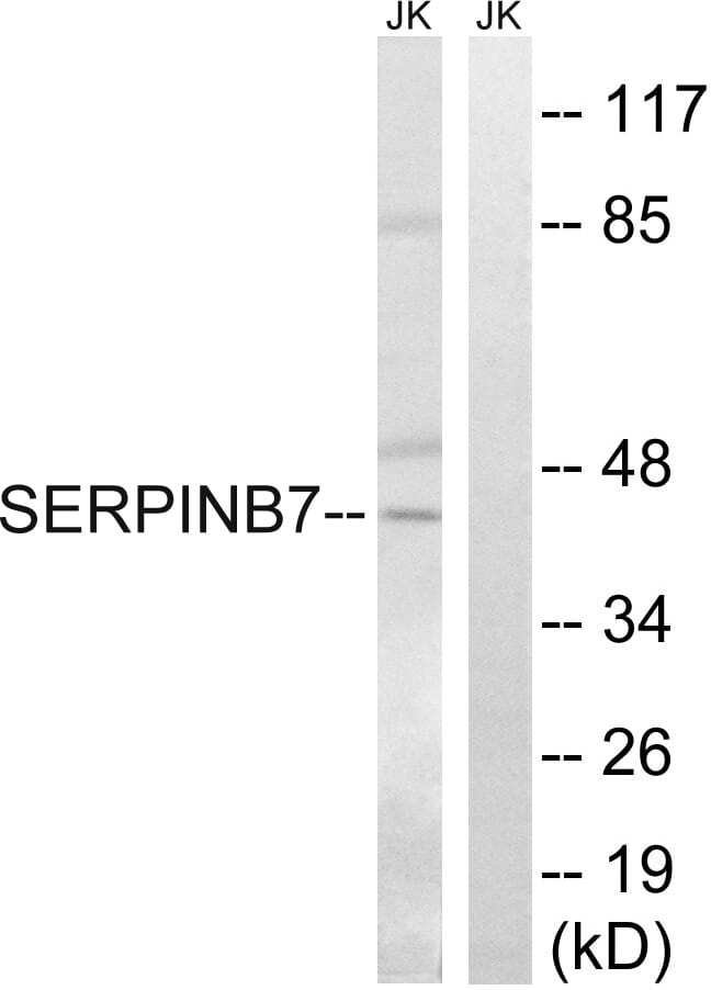 Western blot analysis of lysates from Jurkat cells using Anti-SERPINB7 Antibody. The right hand lane represents a negative control, where the antibody is blocked by the immunising peptide.