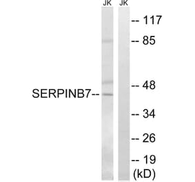 Western Blot - Anti-SERPINB7 Antibody (C18683) - Antibodies.com