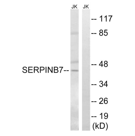 Western Blot - Anti-SERPINB7 Antibody (C18683) - Antibodies.com