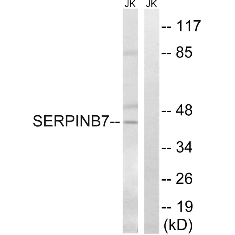 Western Blot - Anti-SERPINB7 Antibody (C18683) - Antibodies.com