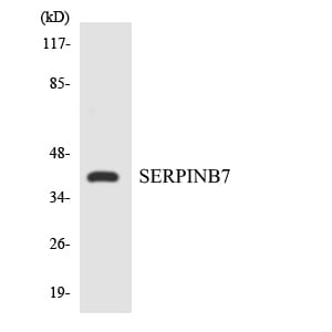 Western blot analysis of the lysates from Jurkat cells using Anti-SERPINB7 Antibody.
