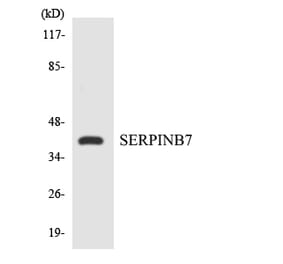 Western Blot - Anti-SERPINB7 Antibody (R12-3495) - Antibodies.com