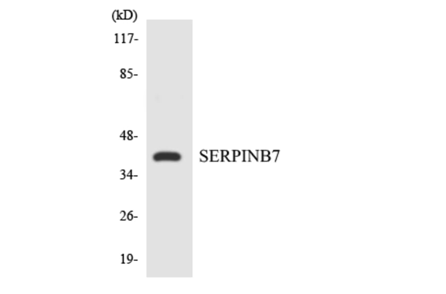 Western Blot - Anti-SERPINB7 Antibody (R12-3495) - Antibodies.com