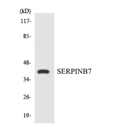 Western Blot - Anti-SERPINB7 Antibody (R12-3495) - Antibodies.com