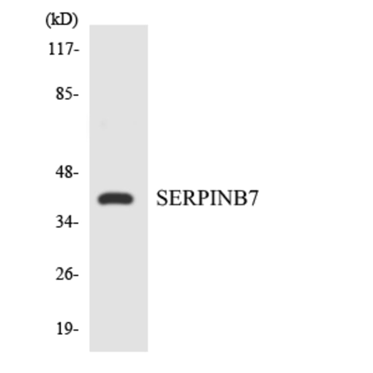 Western Blot - Anti-SERPINB7 Antibody (R12-3495) - Antibodies.com