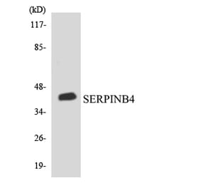 Western Blot - Anti-SERPINB4 Antibody (R12-3494) - Antibodies.com