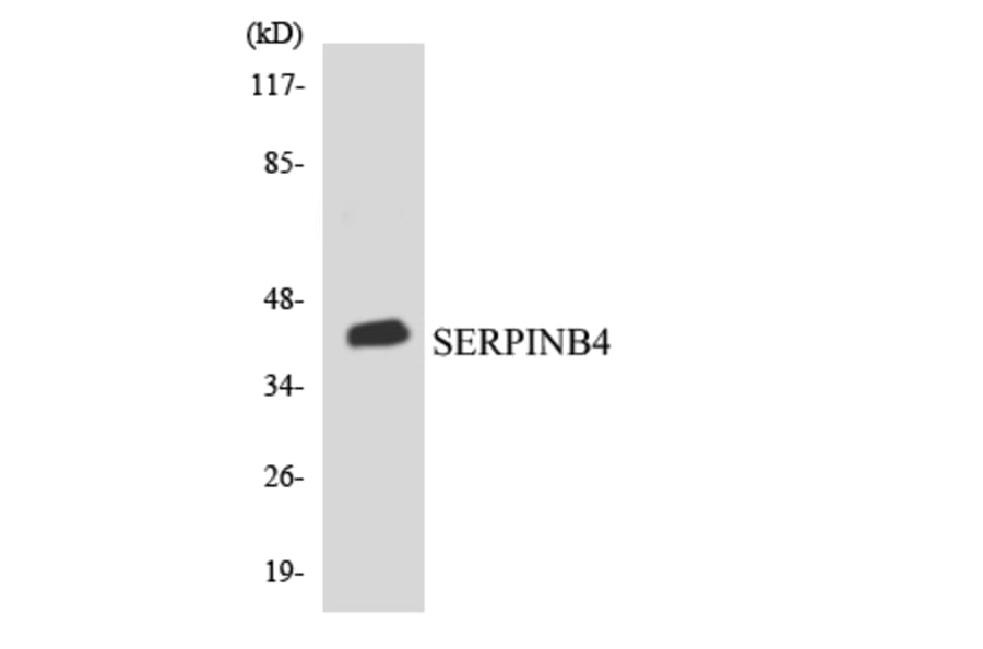 Western Blot - Anti-SERPINB4 Antibody (R12-3494) - Antibodies.com
