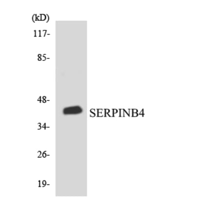 Western Blot - Anti-SERPINB4 Antibody (R12-3494) - Antibodies.com