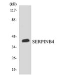 Western Blot - Anti-SERPINB4 Antibody (R12-3494) - Antibodies.com