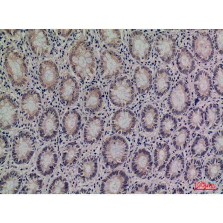 Immunohistochemistry - Anti-SERPINA4 Antibody (C30241) - Antibodies.com