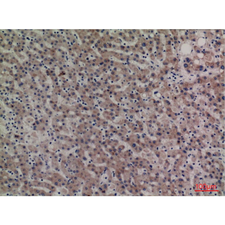Immunohistochemistry - Anti-SERPINA4 Antibody (C30241) - Antibodies.com