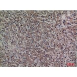 Immunohistochemistry - Anti-SERPINA4 Antibody (C30241) - Antibodies.com