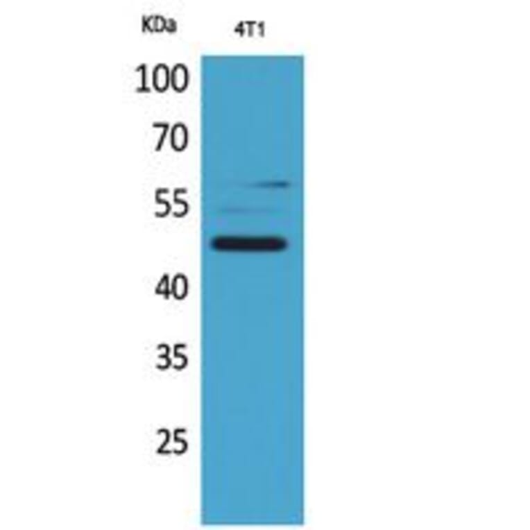 Western Blot - Anti-SERPINA3 Antibody (C30313) - Antibodies.com