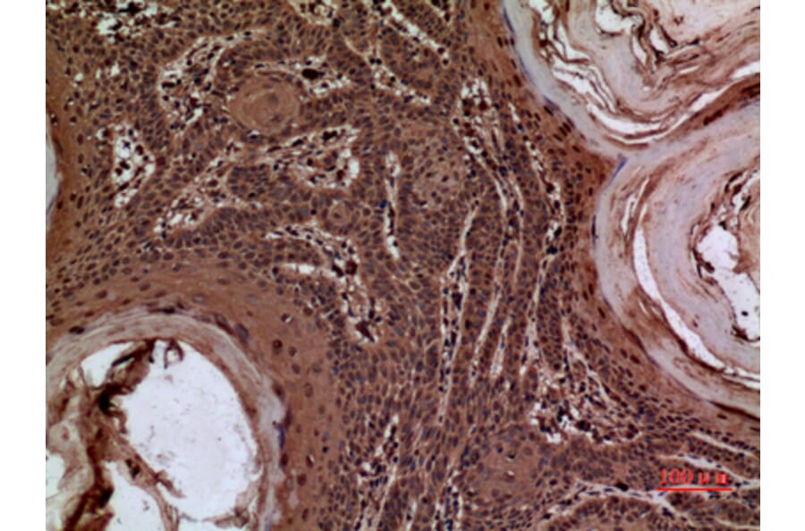 Immunohistochemistry - Anti-SERPINA3 Antibody (C30313) - Antibodies.com
