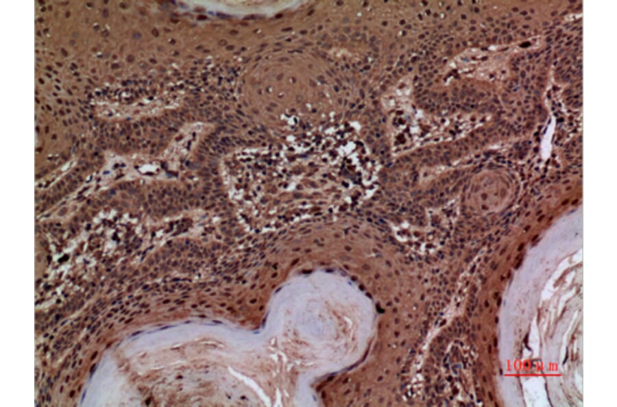 Immunohistochemistry - Anti-SERPINA3 Antibody (C30313) - Antibodies.com