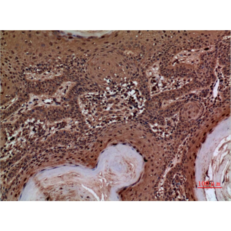 Immunohistochemistry - Anti-SERPINA3 Antibody (C30313) - Antibodies.com