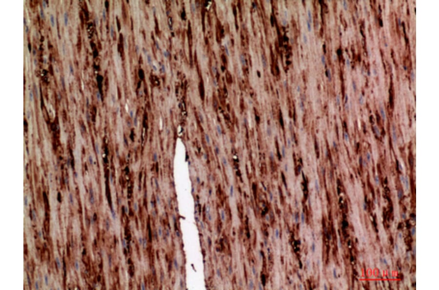 Immunohistochemistry - Anti-SERPINA1 Antibody (C30163) - Antibodies.com