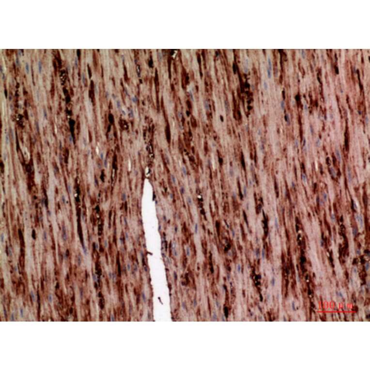 Immunohistochemistry - Anti-SERPINA1 Antibody (C30163) - Antibodies.com