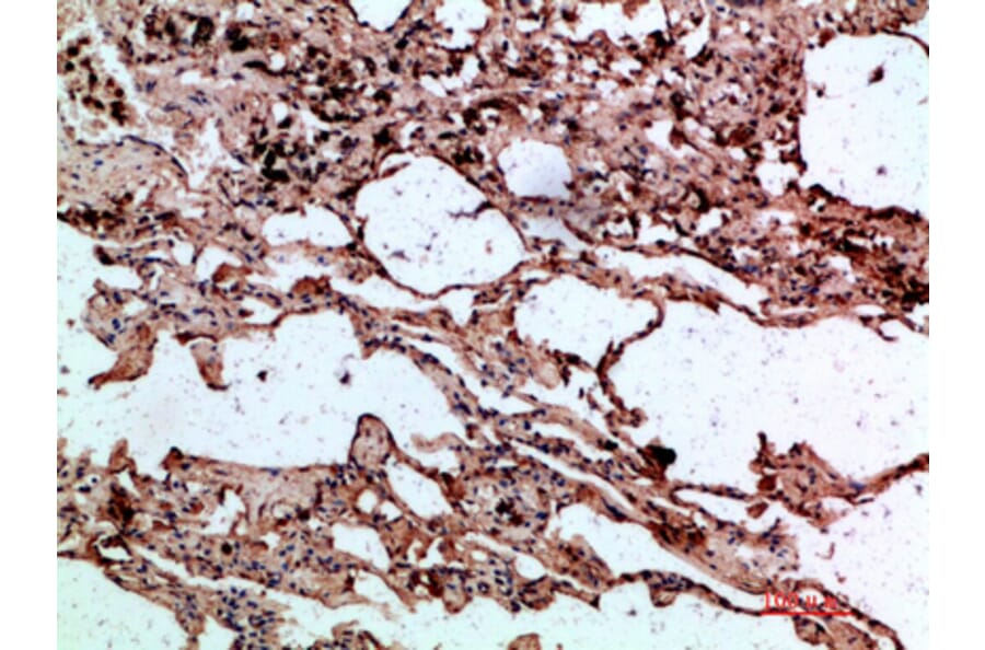 Immunohistochemistry - Anti-SERPINA1 Antibody (C30163) - Antibodies.com