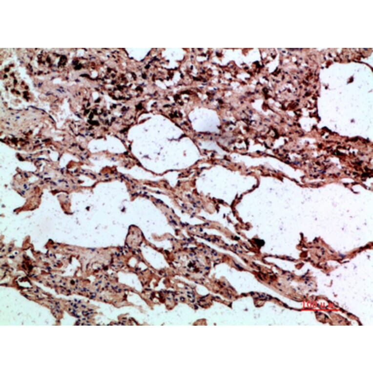 Immunohistochemistry - Anti-SERPINA1 Antibody (C30163) - Antibodies.com