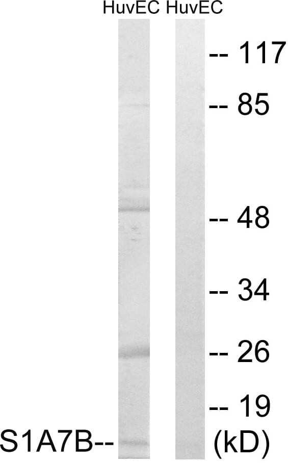Western blot analysis of lysates from HUVEC cells using Anti-S100A7L2 Antibody. The right hand lane represents a negative control, where the antibody is blocked by the immunising peptide.