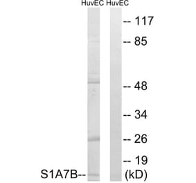Western Blot - Anti-S100A7L2 Antibody (C18052) - Antibodies.com