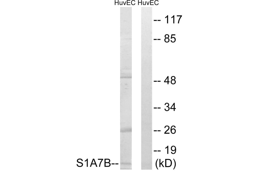 Western Blot - Anti-S100A7L2 Antibody (C18052) - Antibodies.com