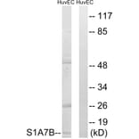 Western Blot - Anti-S100A7L2 Antibody (C18052) - Antibodies.com