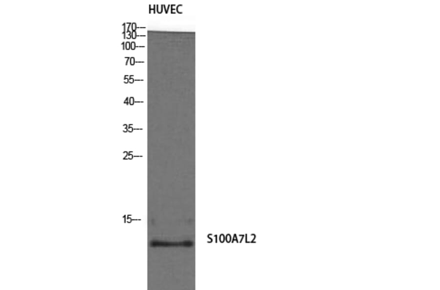Western Blot - Anti-S100A7L2 Antibody (C18052) - Antibodies.com