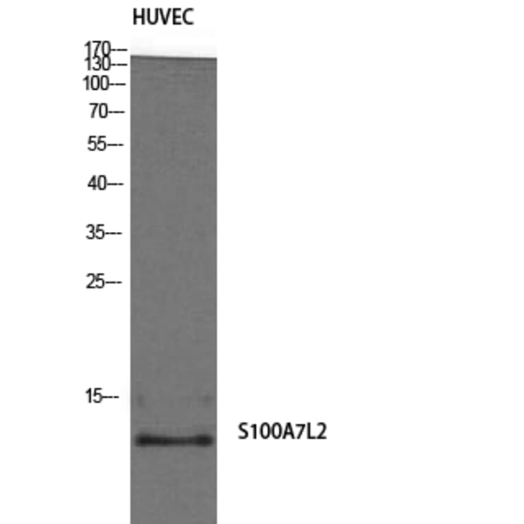 Western Blot - Anti-S100A7L2 Antibody (C18052) - Antibodies.com