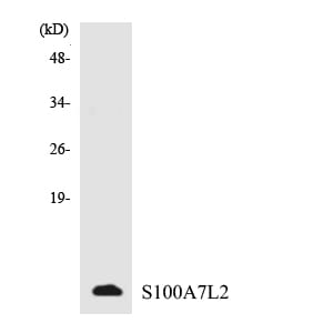 Western blot analysis of the lysates from HepG2 cells using Anti-S100A7L2 Antibody.