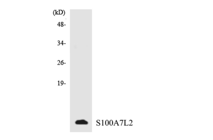 Western Blot - Anti-S100A7L2 Antibody (R12-3476) - Antibodies.com