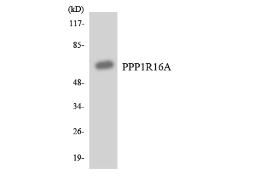 Western Blot - Anti-PPP1R16A Antibody (R12-3348) - Antibodies.com