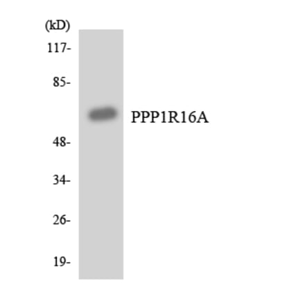 Western Blot - Anti-PPP1R16A Antibody (R12-3348) - Antibodies.com