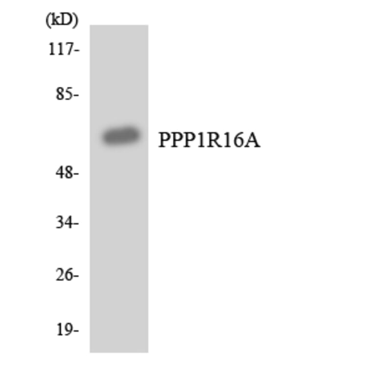 Western Blot - Anti-PPP1R16A Antibody (R12-3348) - Antibodies.com