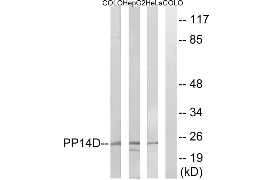 Western Blot - Anti-PPP1R14D Antibody (C18009) - Antibodies.com