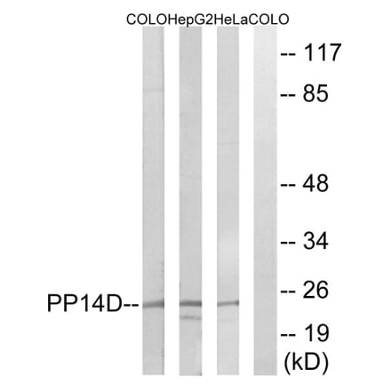 Western Blot - Anti-PPP1R14D Antibody (C18009) - Antibodies.com