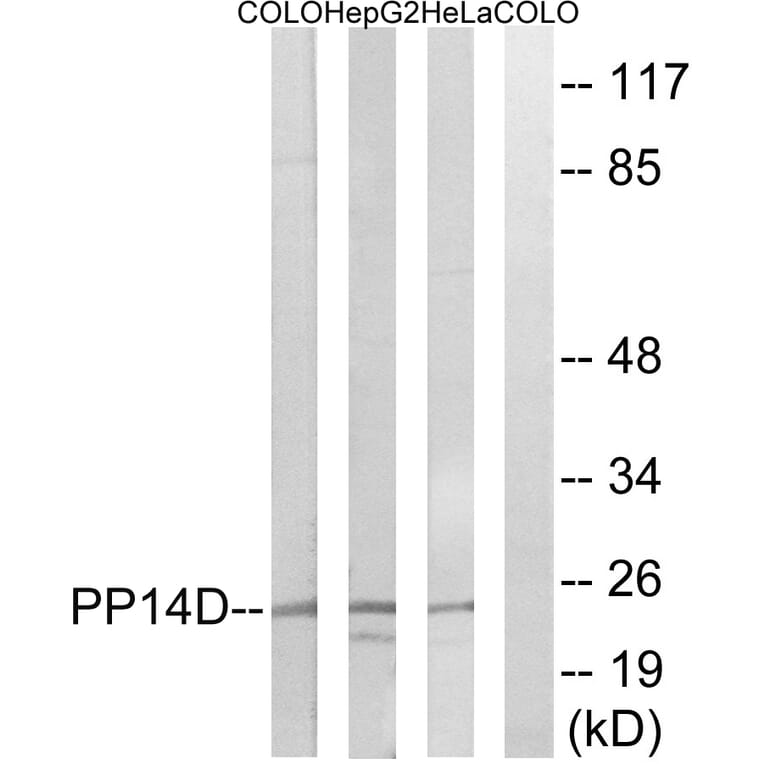Western Blot - Anti-PPP1R14D Antibody (C18009) - Antibodies.com