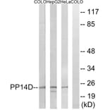 Western Blot - Anti-PPP1R14D Antibody (C18009) - Antibodies.com