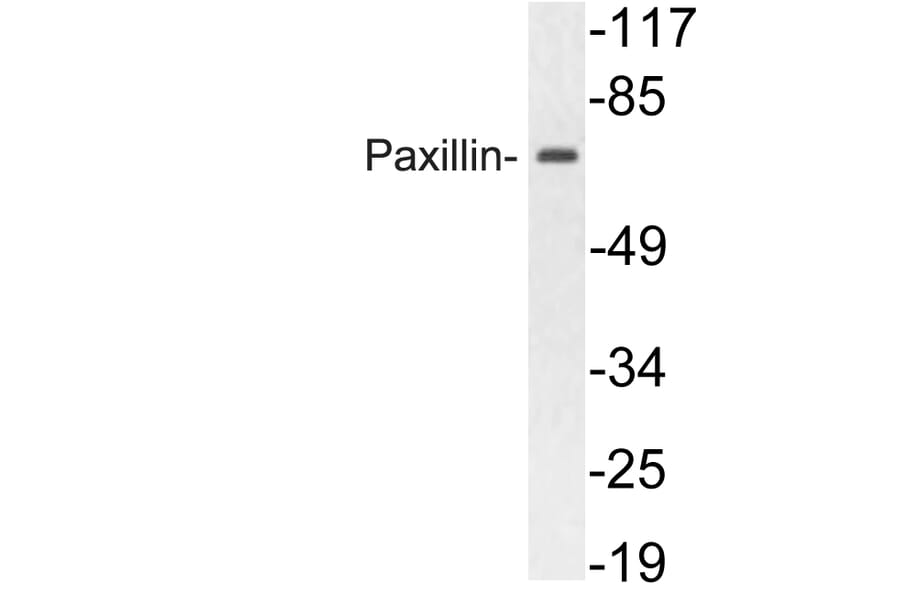 Western Blot - Anti-Paxillin Antibody (R12-2296) - Antibodies.com